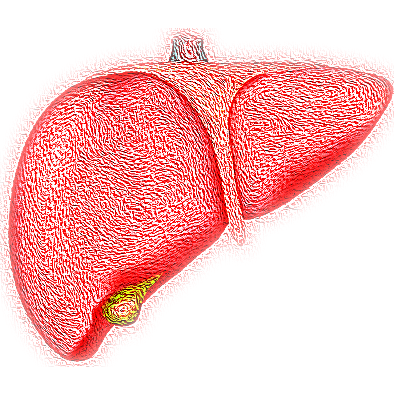 liver-VSRao liver-VSRao