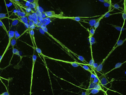Biostampa 3D per la medicina personalizzata